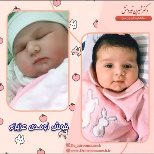 زایمان-توسط-دکتر-نیرومنش-15