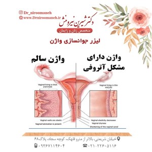 لیزر جوانسازی واژن _ دکتر نیرومنش