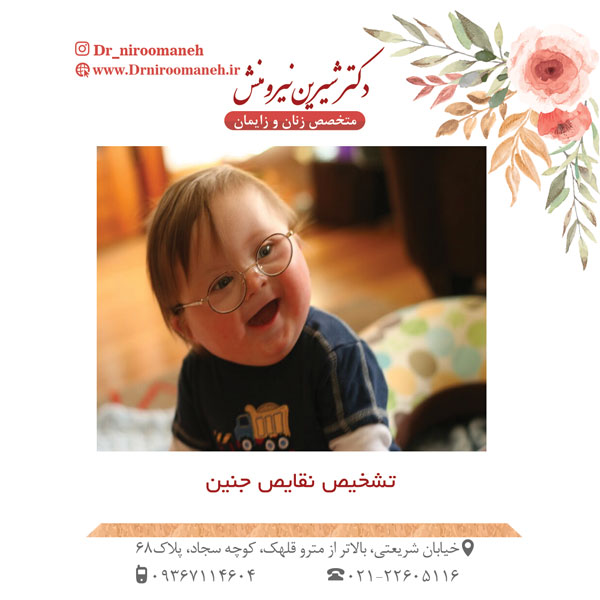 عکس سندروم داون + تشخیص نقایص جنین