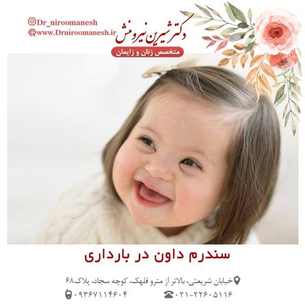 سندرم داون در بارداری