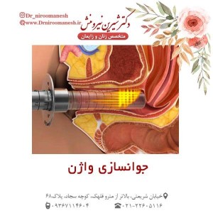 جوانسازی واژن