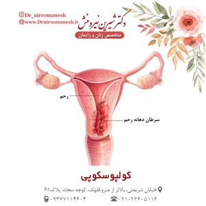 کولپوسکوپی