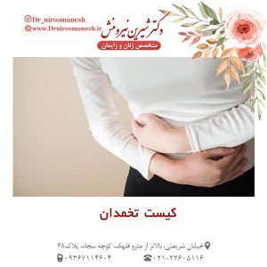 کیست تخمدان - دکتر نیرومنش