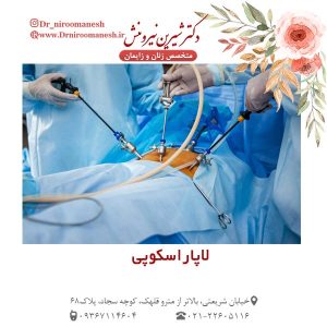 لاپاراسکوپی