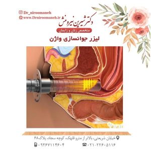 لیزر جوانسازی واژن _ دکتر شیرین نیرومنش