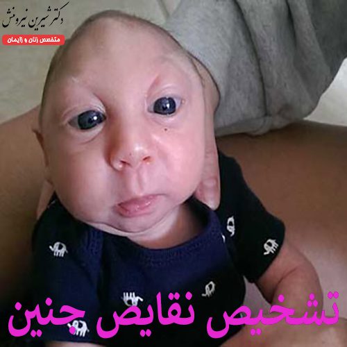 عکس نقص جنینی - عکس جنین ناقص