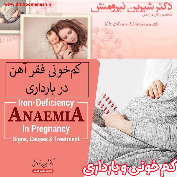 کم خونی فقر آهن در بارداری (2)