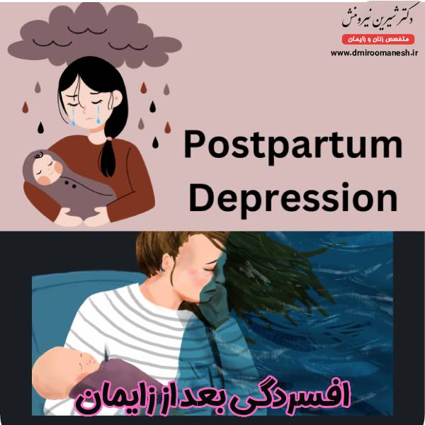 افسردگی بعد از زایمان - دکتر شیرین نیرومنش